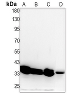 PPP2CA (Phospho-Y307) Rabbit Monoclonal Antibody