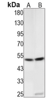 PRKAR2A (Phospho-S99) Rabbit Monoclonal Antibody
