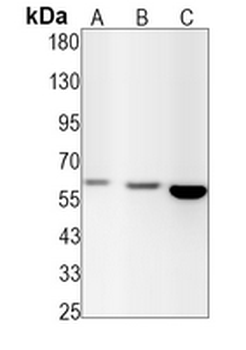c-Myc (Phospho-T58+S62) Rabbit Monoclonal Antibody
