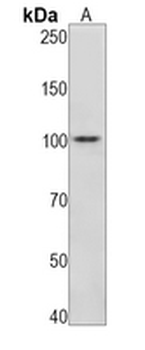 Nucleolin (Phospho-T76) Rabbit Monoclonal Antibody