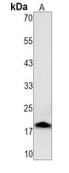 PTPS (Phospho-S19) Rabbit Monoclonal Antibody