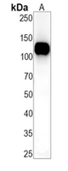 c-CBL (Phospho-S669) Rabbit Monoclonal Antibody