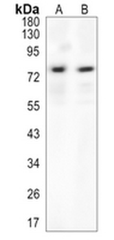 Abi-2 Rabbit Monoclonal Antibody