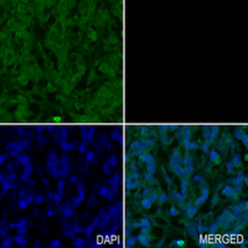 Abi-2 Rabbit Monoclonal Antibody