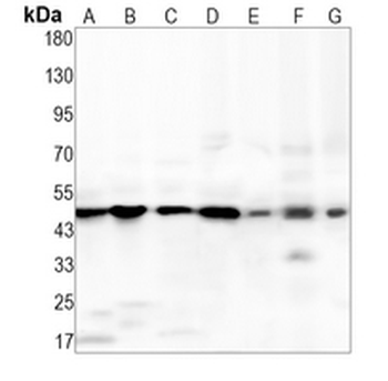 IL-11RA Rabbit Monoclonal Antibody