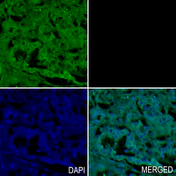 PI3-kinase p150 Rabbit Monoclonal Antibody