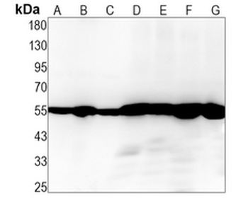 DLD Rabbit Monoclonal Antibody