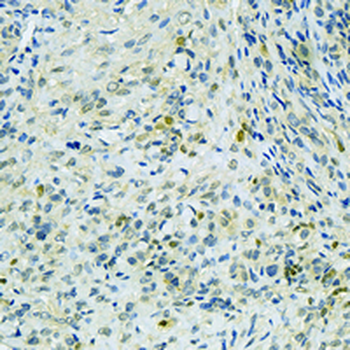 KAP3 Rabbit Monoclonal Antibody