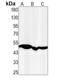 ABAT Rabbit Monoclonal Antibody
