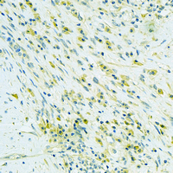ABAT Rabbit Monoclonal Antibody
