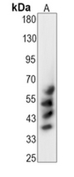 CD147 Rabbit Monoclonal Antibody