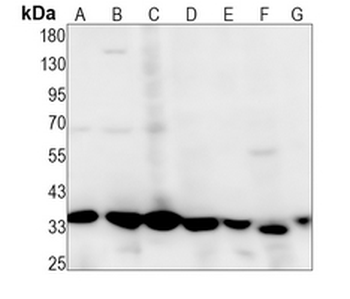 PSMD14 Rabbit Monoclonal Antibody