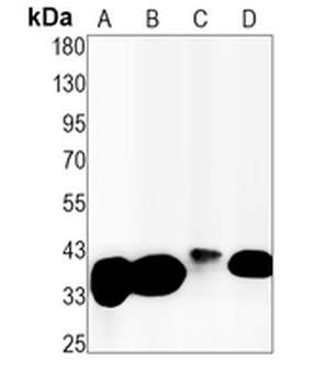 FBP1 Rabbit Monoclonal Antibody