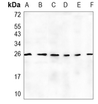 LYPLA1 Rabbit Monoclonal Antibody