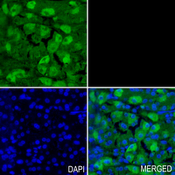 LYPLA1 Rabbit Monoclonal Antibody