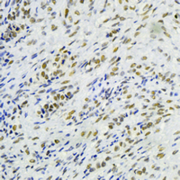 RNF40 Rabbit Monoclonal Antibody