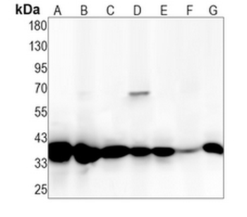 PP1 beta Rabbit Monoclonal Antibody