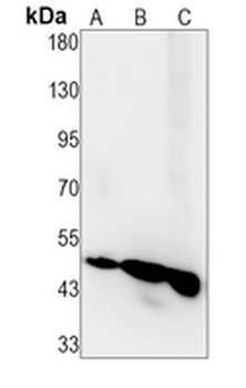 FDFT1 Rabbit Monoclonal Antibody
