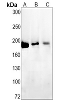 PB1 Rabbit Monoclonal Antibody