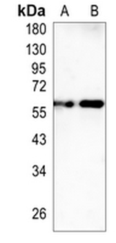 GRB7 Rabbit Monoclonal Antibody