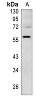 TDT Rabbit Monoclonal Antibody