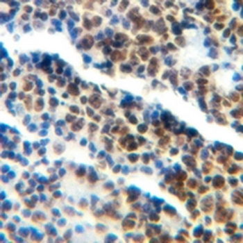 TDT Rabbit Monoclonal Antibody
