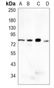 CD10 Rabbit Monoclonal Antibody