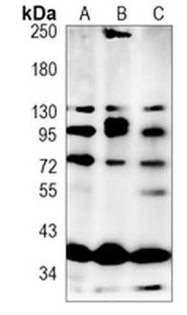 FOXP1 Rabbit Monoclonal Antibody