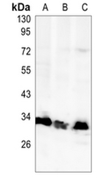 MBD3 Rabbit Monoclonal Antibody