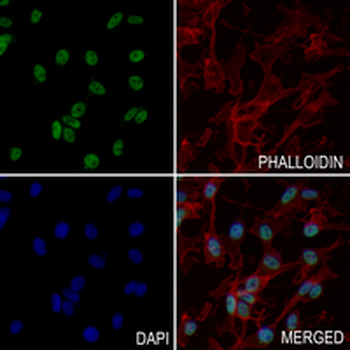 MBD3 Rabbit Monoclonal Antibody