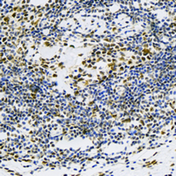 KSRP Rabbit Monoclonal Antibody