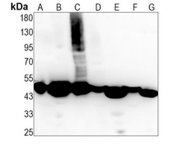 EEF1A1 Rabbit Monoclonal Antibody