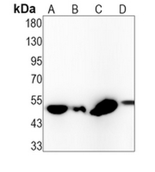SFRP4 Rabbit Monoclonal Antibody