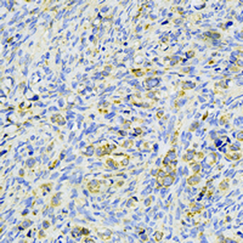 SFRP4 Rabbit Monoclonal Antibody