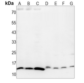 PEN-2 Rabbit Monoclonal Antibody