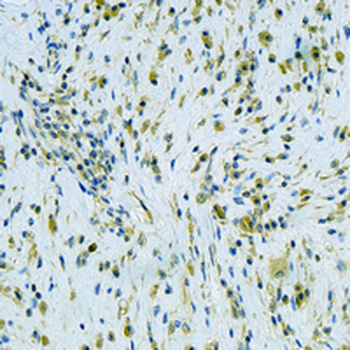 PEN-2 Rabbit Monoclonal Antibody