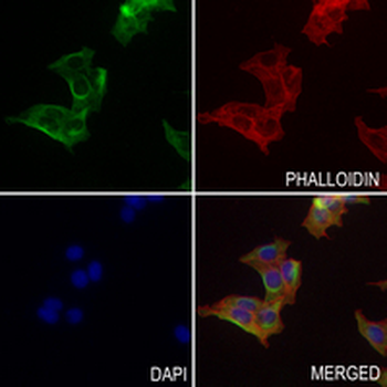 Lumican Rabbit Monoclonal Antibody