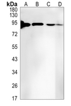 RRM1 Rabbit Monoclonal Antibody