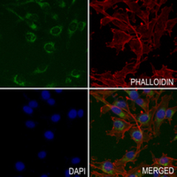 Aconitase 2 Rabbit Monoclonal Antibody