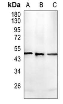 Cytochrome P450 4A11 Rabbit Monoclonal Antibody