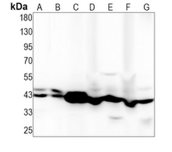 ARP2 Rabbit Monoclonal Antibody