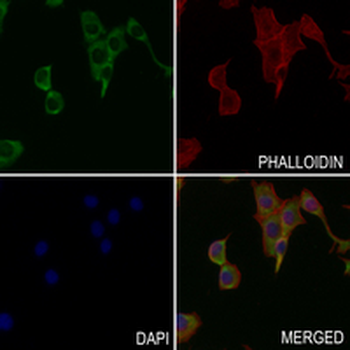 FXR1 Rabbit Monoclonal Antibody