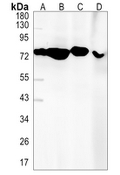 LysRS Rabbit Monoclonal Antibody