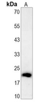 Perp Rabbit Monoclonal Antibody