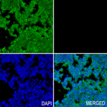 Coilin Rabbit Monoclonal Antibody