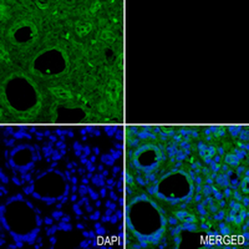 K Cadherin Rabbit Monoclonal Antibody