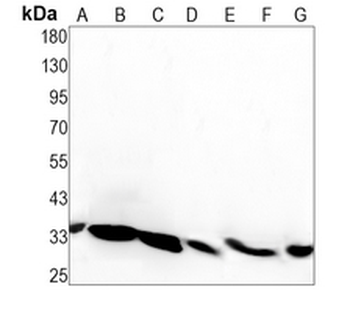 RACK1 Rabbit Monoclonal Antibody