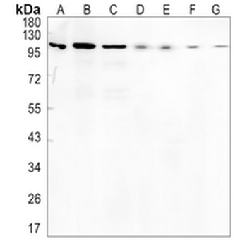 MCM3 Rabbit Monoclonal Antibody