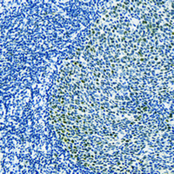 MCM3 Rabbit Monoclonal Antibody