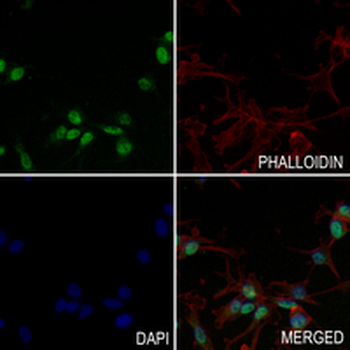 MCM3 Rabbit Monoclonal Antibody